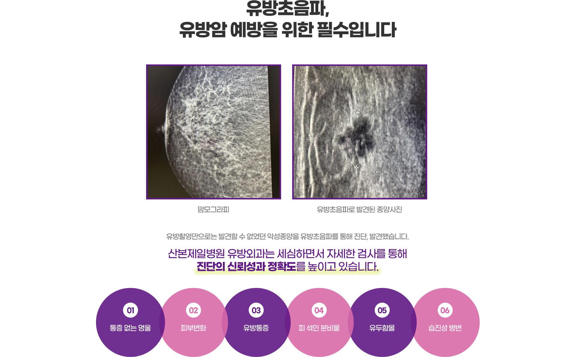 유방초음파, 유방암 예방을 위한 필수입니다.